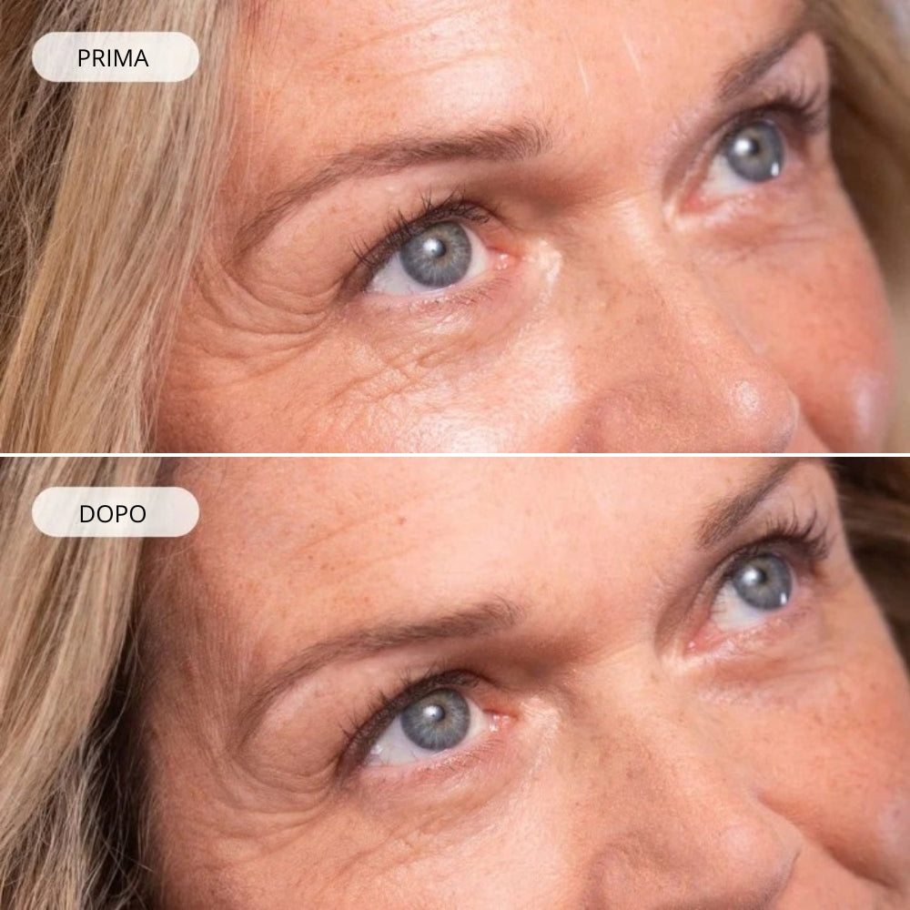 Trattamento liftante viso Anti-age Effetto Filler immediato